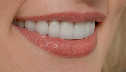 Close view of flawless healthy smile