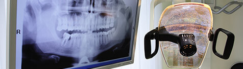 Panoramic dental x-ray on chairside monitor
