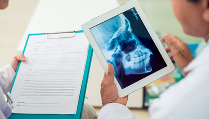 Dentists looking at x-ray on tablet