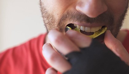 Man putting yellow mouthguard over upper arch
