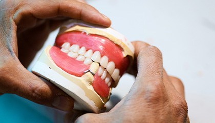 Hands holding model mouth with dentures