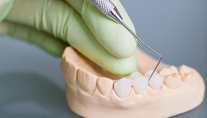Dentist using dental tool to point to model of dental bridge