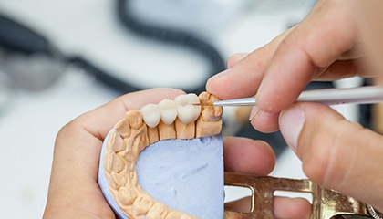Lab artisan working on dental bridge