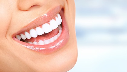 a close-up of a woman’s smile