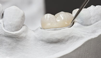 Model of tooth with dental crown