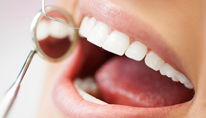 Closeup of smile during professional teeth cleaning