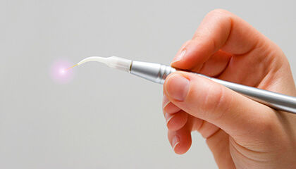 Hand holding laser dentistry tool