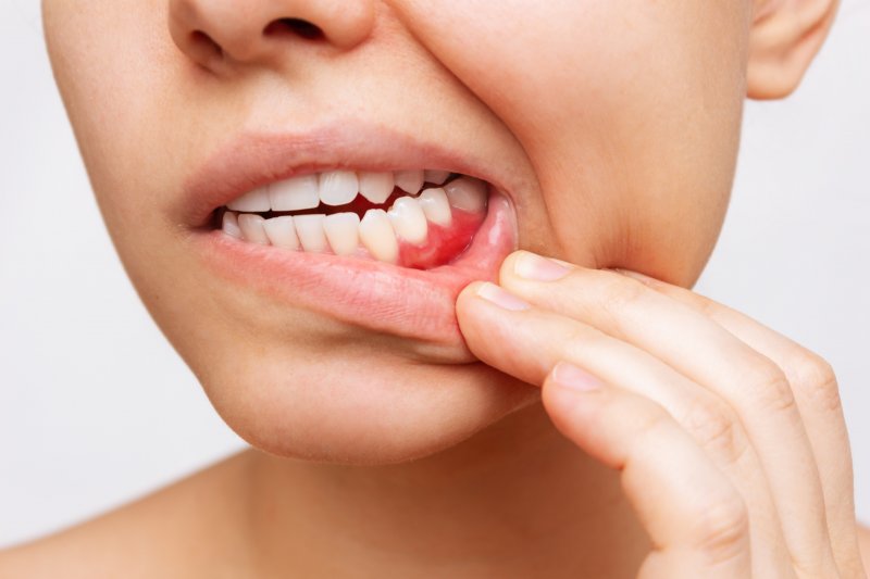 Dental patient's gums